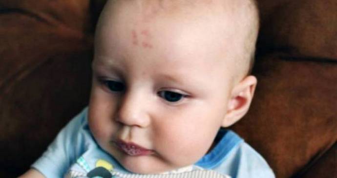 Dél-Afrikában a fiút születési jelöléssel látják el - a tizenkét számot.