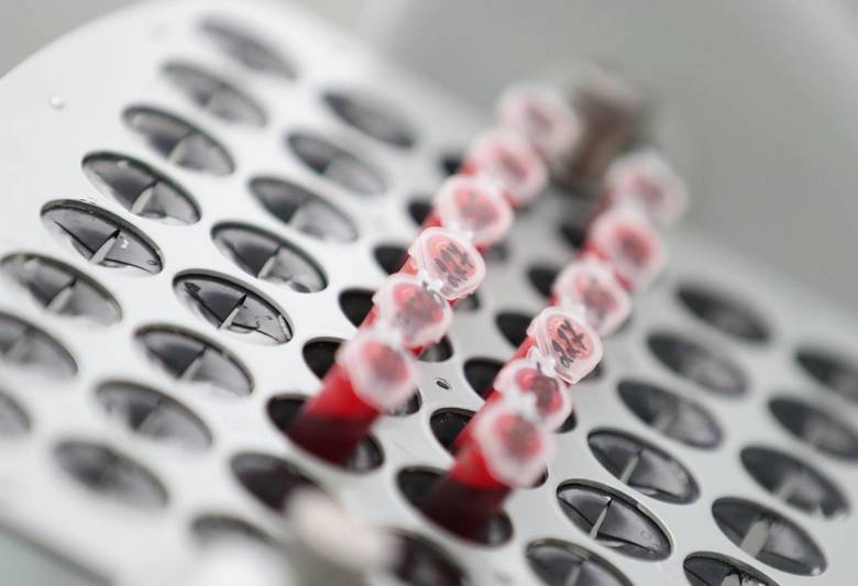 Franciaországban kitalálták, hogyan lehet fecskendő nélkül beinjektálni ruhákat