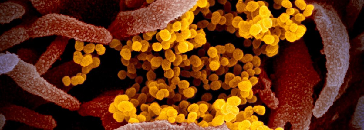 Így néz ki a COVID-19 vírus mikroszkóp alatt 