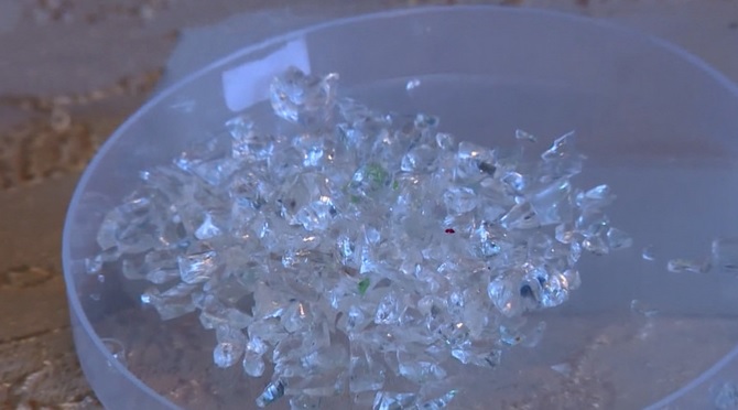 Az orvosok össze vannak zavarodva: az örmény lány sír kristályokkal