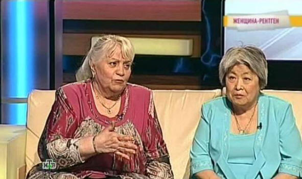 Julia Vorobyova - a Hihetetlen röntgen nő