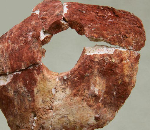 Miért hatezer évvel ezelőtt a sebészek trepanáltak