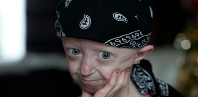 Haley Okins titokzatos története: egy 17 éves lány egy 104 éves nő testében