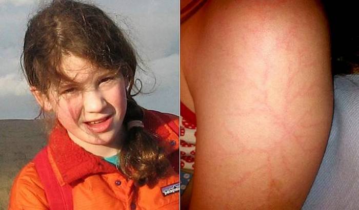 Titokzatos rajzok az oroszok bőrén